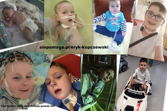 7-letni Eryk z okolic Łomży walczy z ciężką chorobą serca - wesprzyj zbiórkę na leczenie
